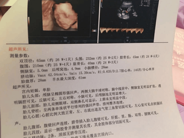 二胎淘气包小王子驾到, 有需要的快来接, 2018都能接到狗年小王子