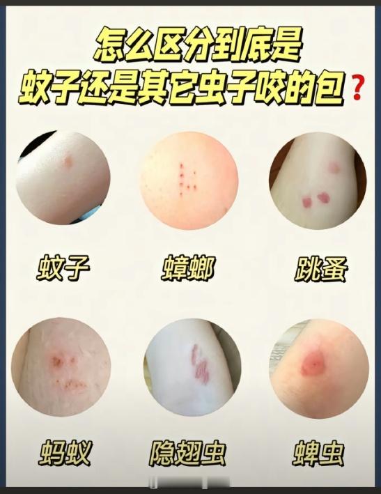蟑螂咬人恐怖故事+1，广东的蟑螂不仅会飞...还会咬人上一周才跟一直巨大的蟑螂