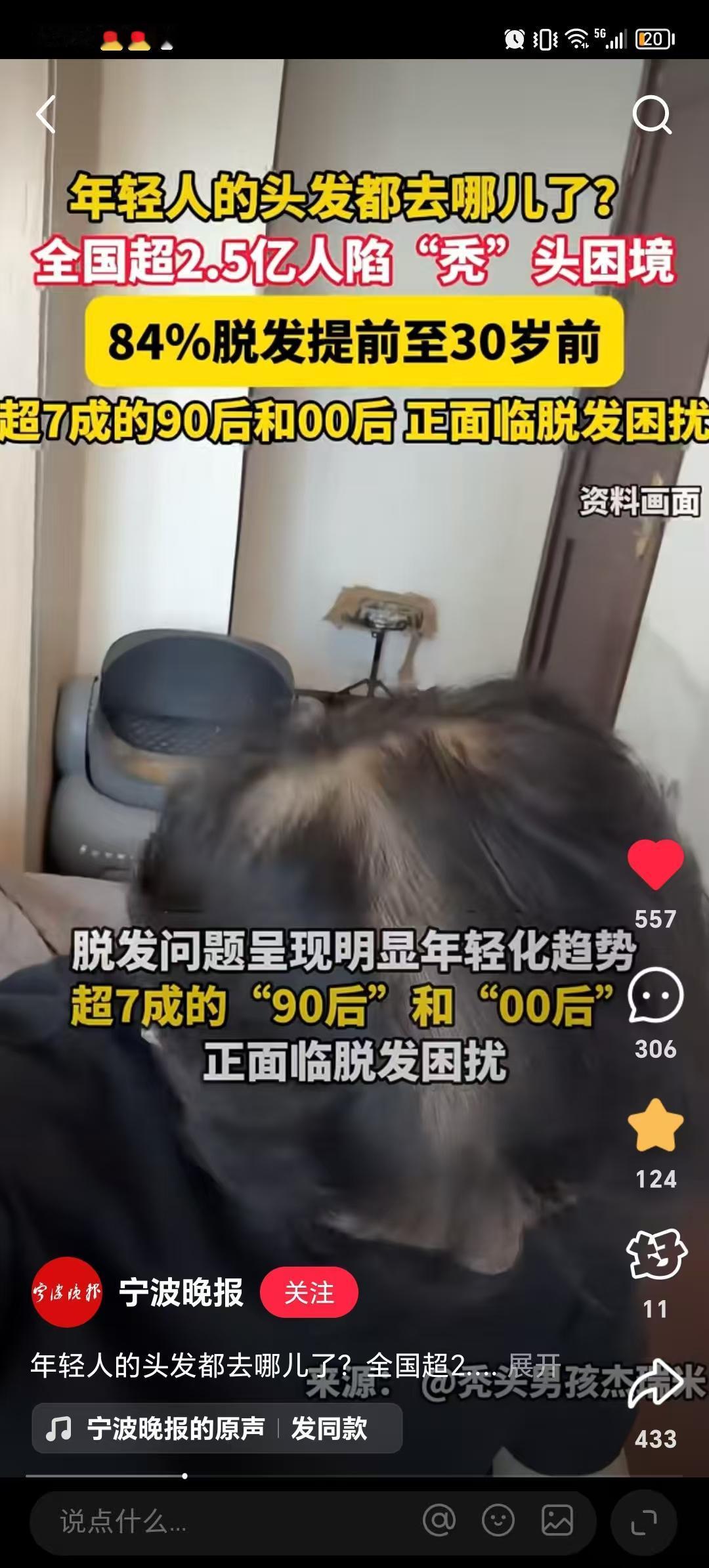 大家发现没？年轻人的头发，越来越稀少陷入“秃头”的困境！有调查表示，全国