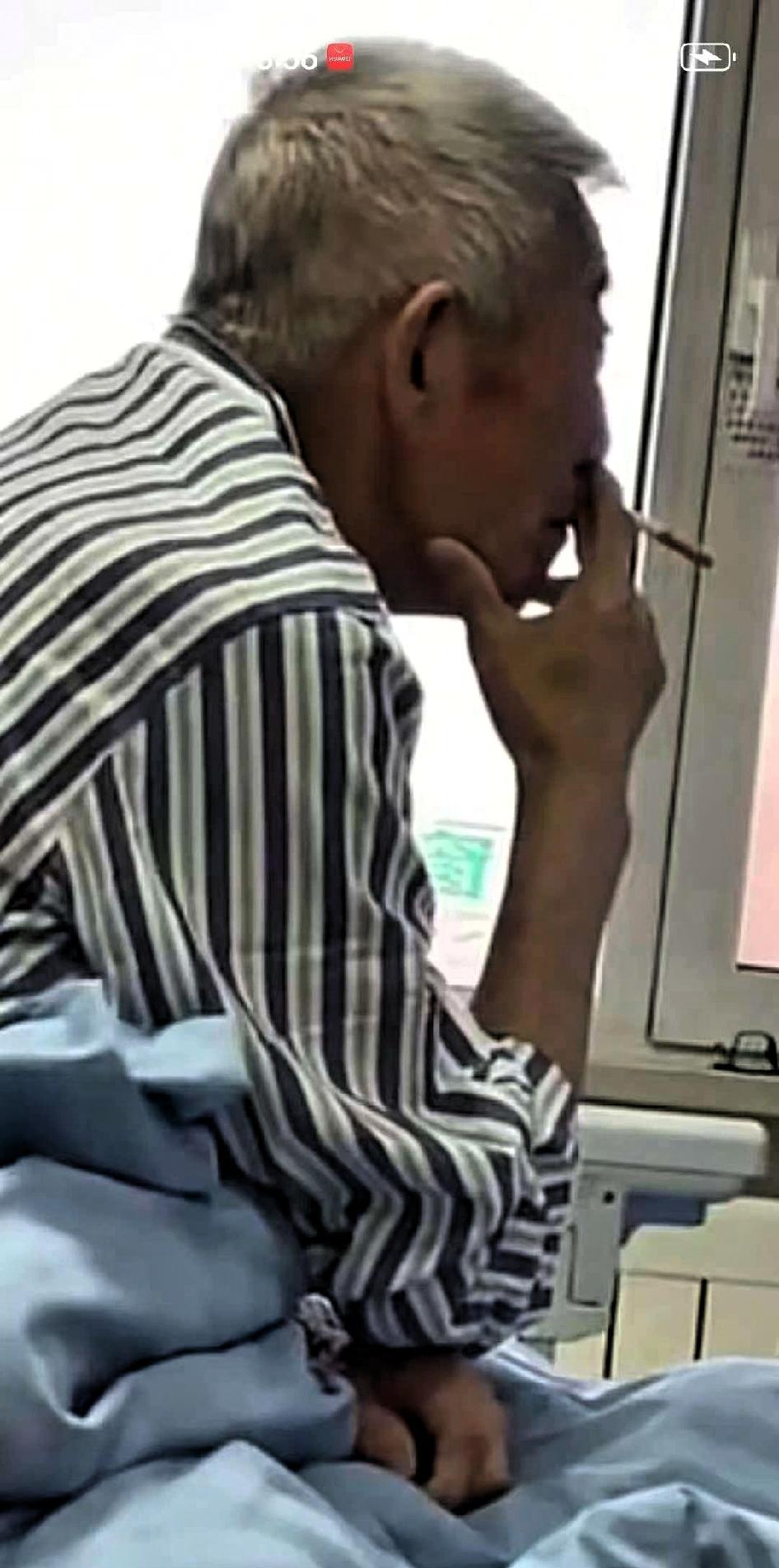无语了，真不要命了，父亲肝癌晚期，在医院治疗中，趁医生不备，又偷偷吸烟，被儿子发