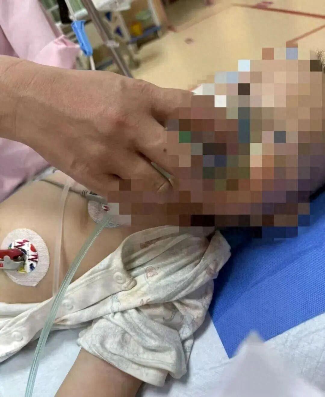 “太吓人了！”贵州贵阳，1岁男童在家门口吃了枚“捡来的鸡蛋”，凌晨突然抽搐、意识