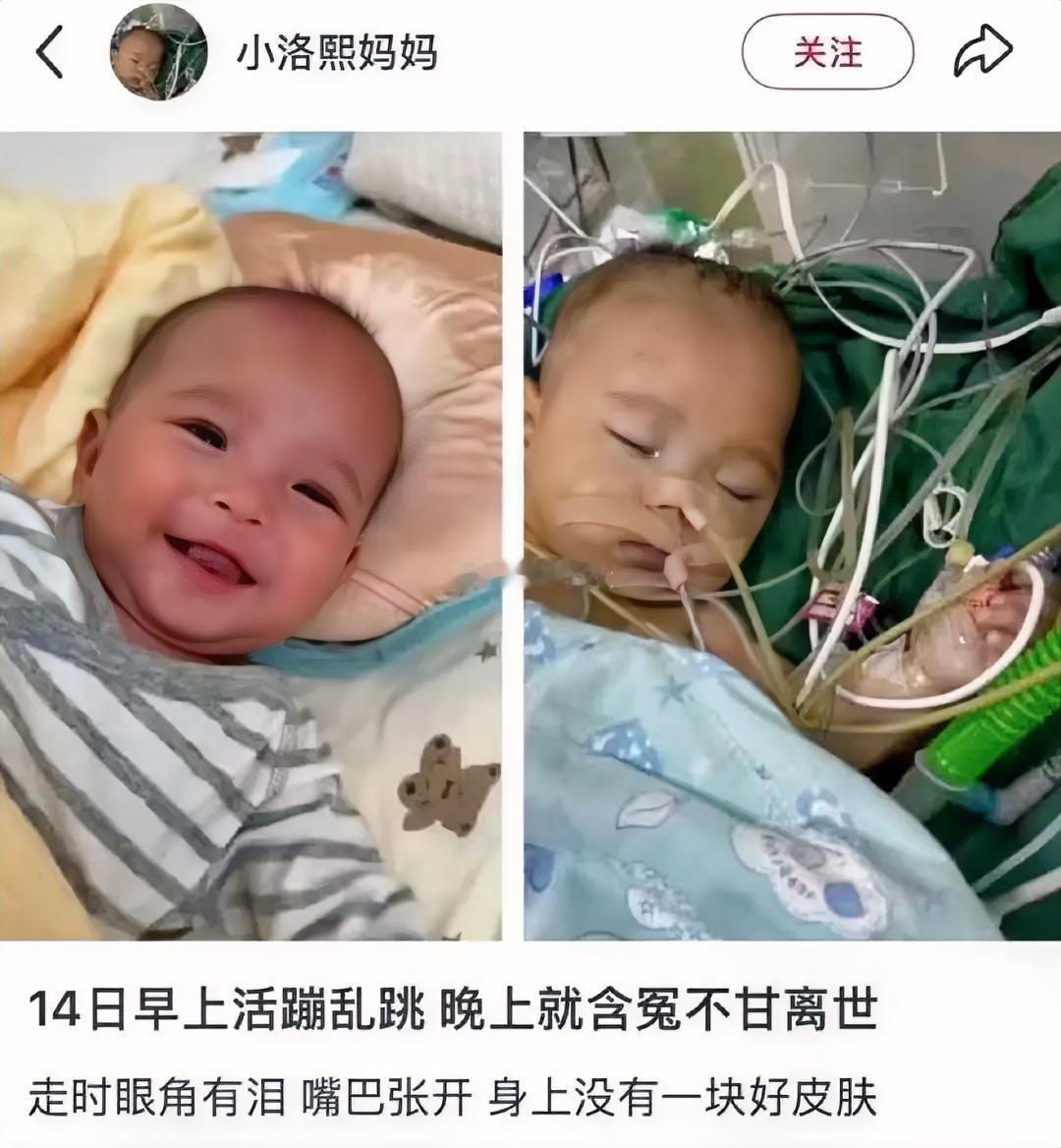 宁波五月龄宝宝心脏病手术离世细节：1、宝宝早产，后身体经家人照顾健康，因例行