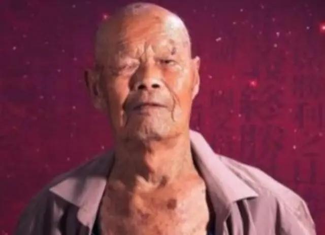 1956年，35岁农民咳嗽10年，竟拒绝就医，一天，他突然用力咳嗽，“哇”的一声