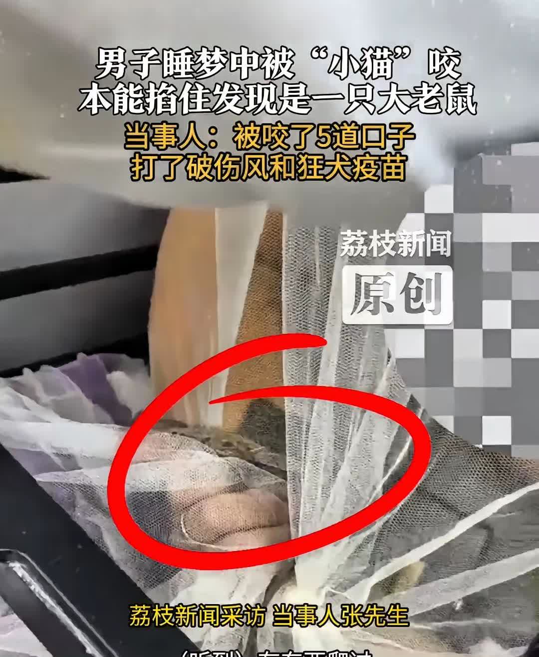 “太后怕了！”江苏无锡，一男子睡梦中感觉手边有什么东西爬过，毛绒绒的，他以为是家