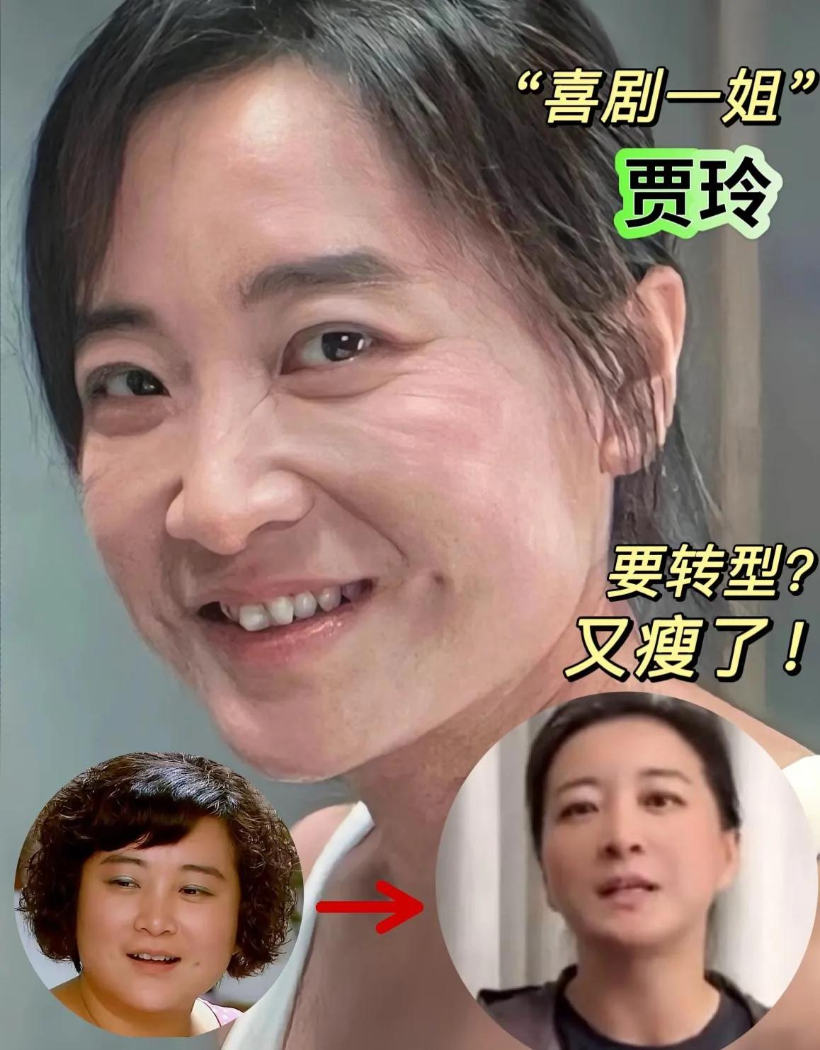 贾玲暴瘦后状态引热议，你更爱哪个她？“喜剧一姐”贾玲瘦到认不出！从210斤