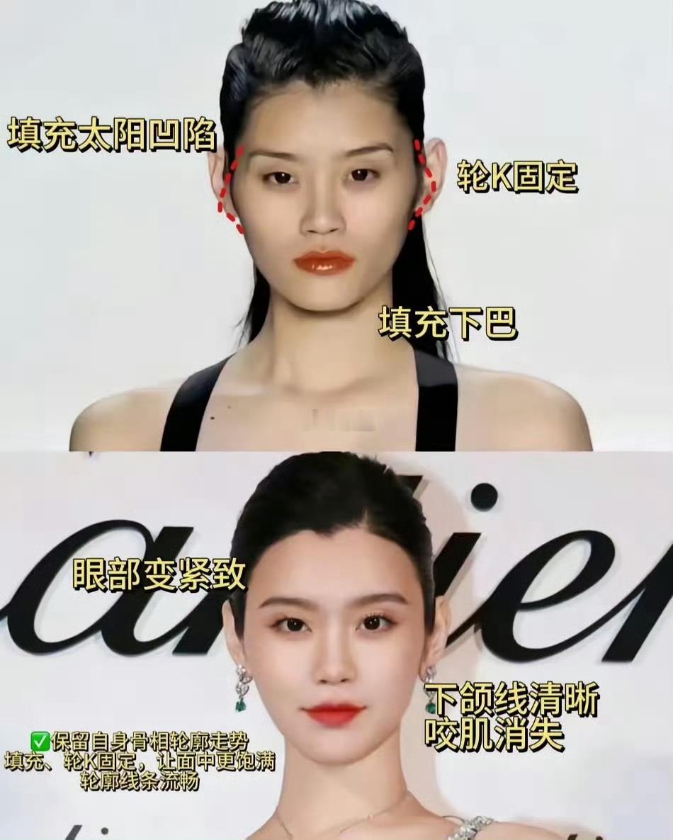 最佩服的其实是奚梦瑶的美商。当模特时，她是高级脸，嫁入豪门之后，又自然切换成了面