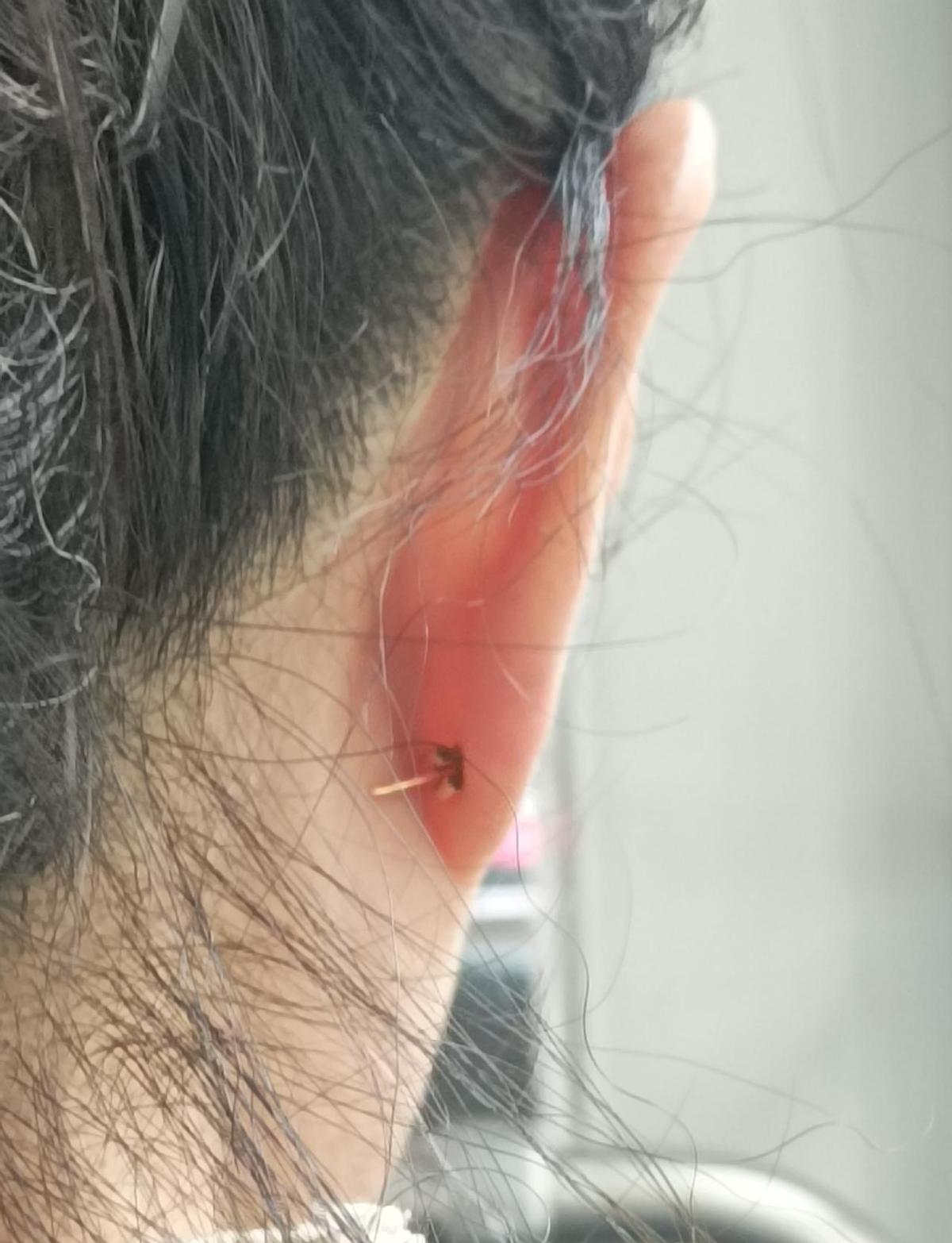 戴个耳钉像挂了根小旗杆，走路带风，回头率是高，可脖子痒得想抓狂。不是所有长款都