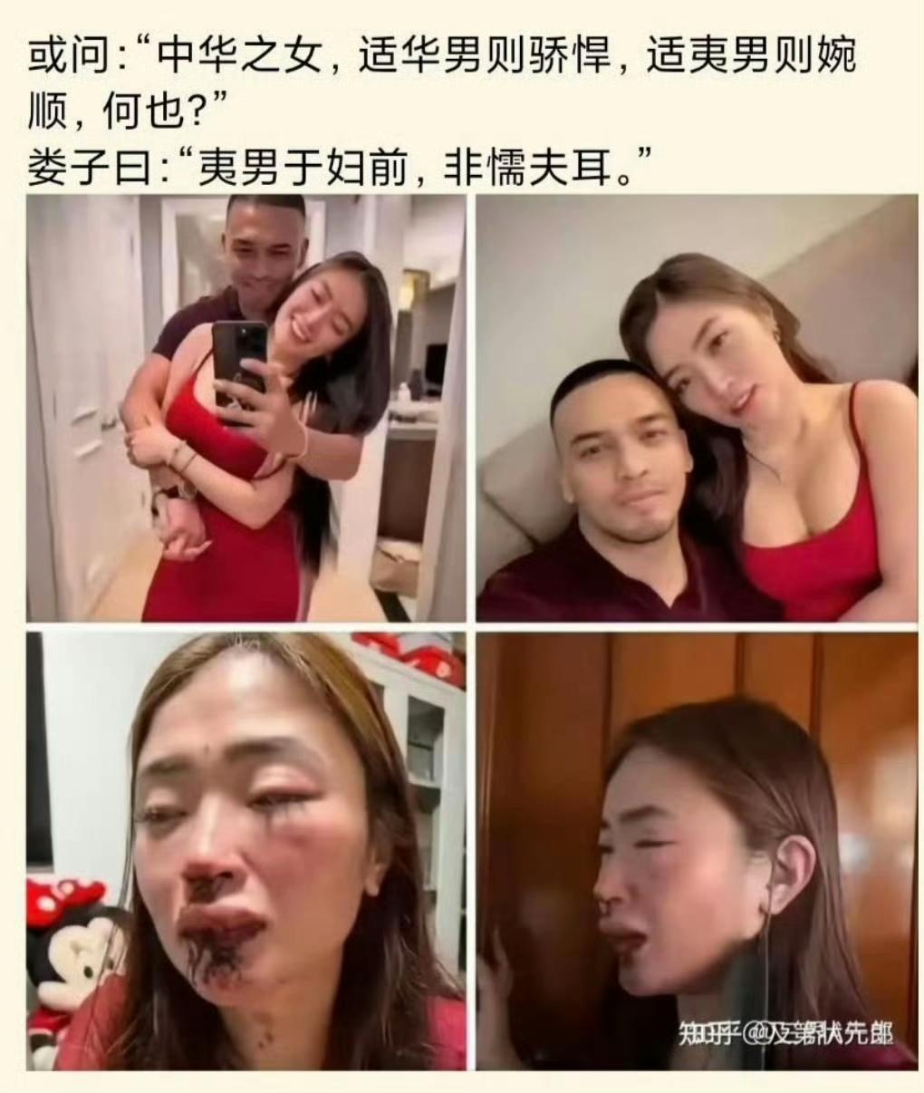 还是西药见效快！[呲牙笑][呲牙笑][呲牙笑]