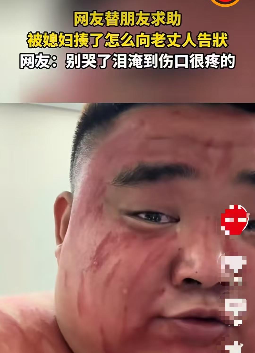 笑不活了！湖北，一男子在家跟媳妇起了冲突，结果不仅没吵赢，还被媳妇给收拾了一顿，