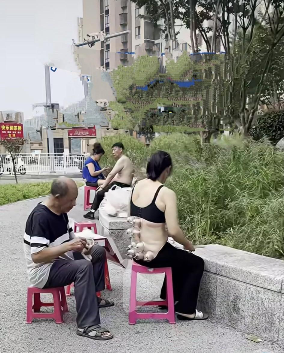很不理解这些人的行为！在户外拔罐扎针就不怕中风吗？干嘛不去室内？穿成这样既