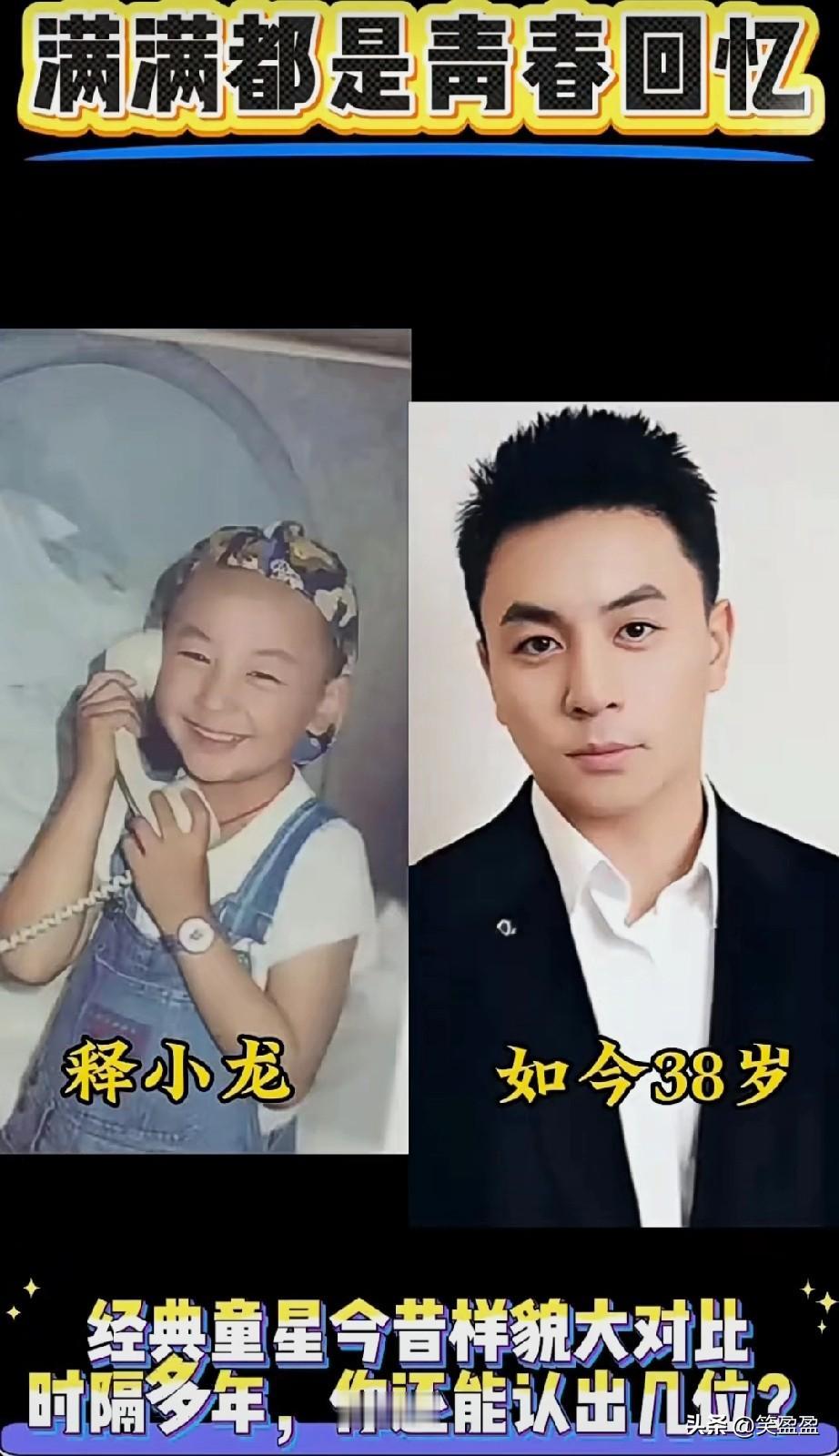 5位经典童星今昔容貌大对比时隔多年，你还能认出几位？