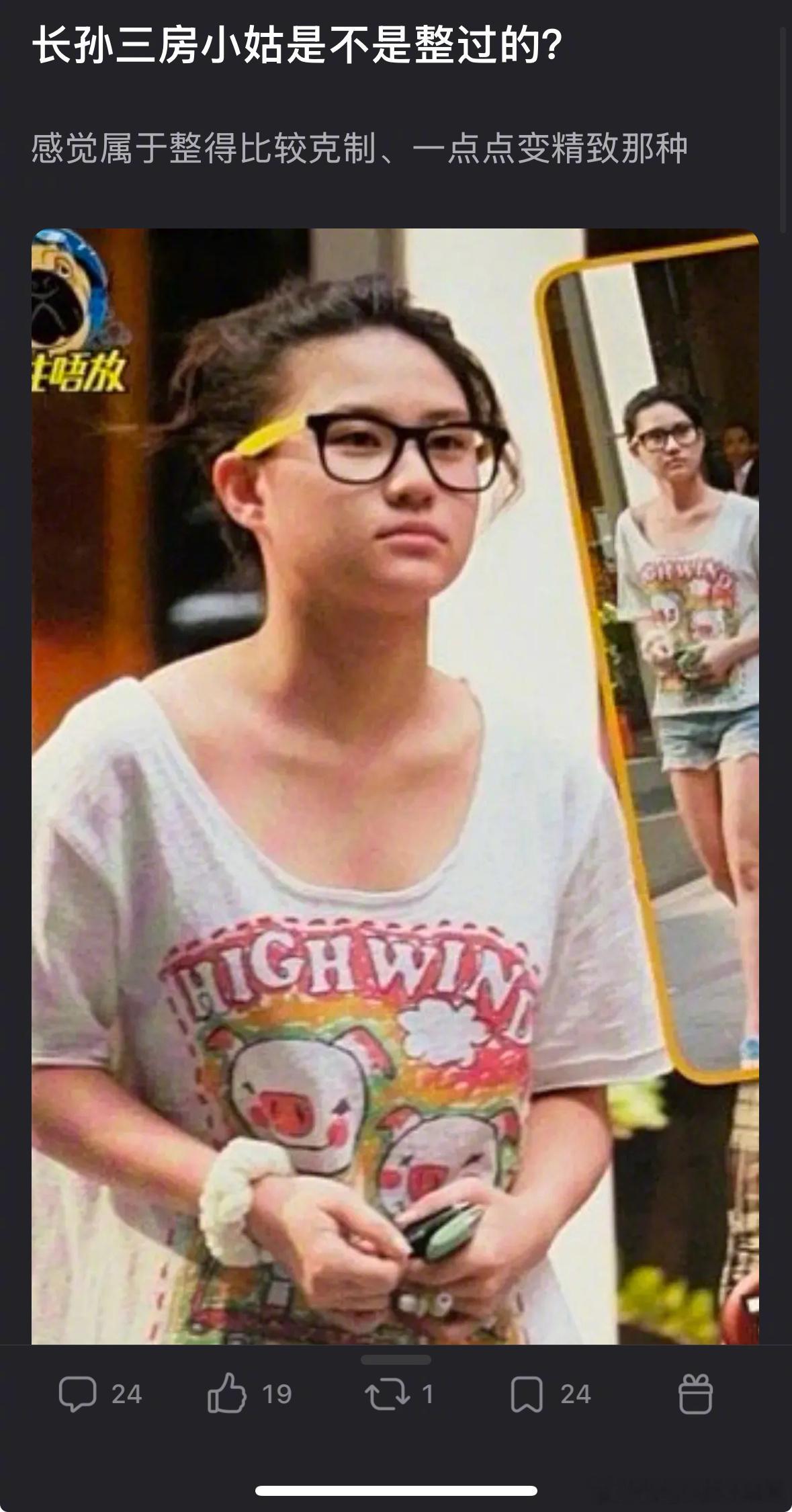 何超莲的脸看着像do过的吗？​​​