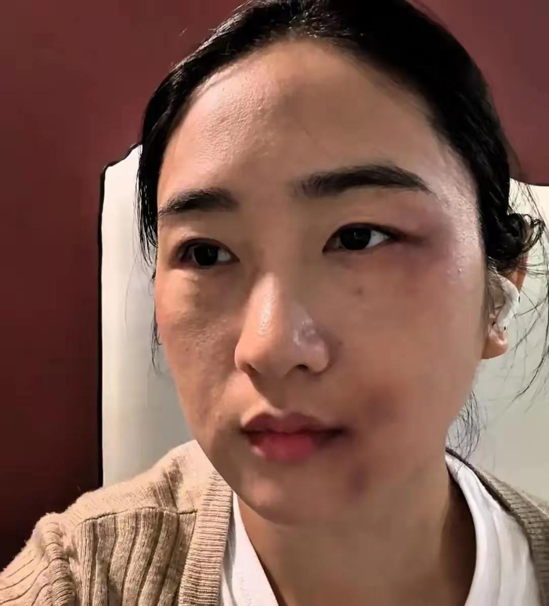 王姐被家暴十几年，前天终于爆发了，她问上初中的儿子"你爸再打我你帮谁"，儿子头