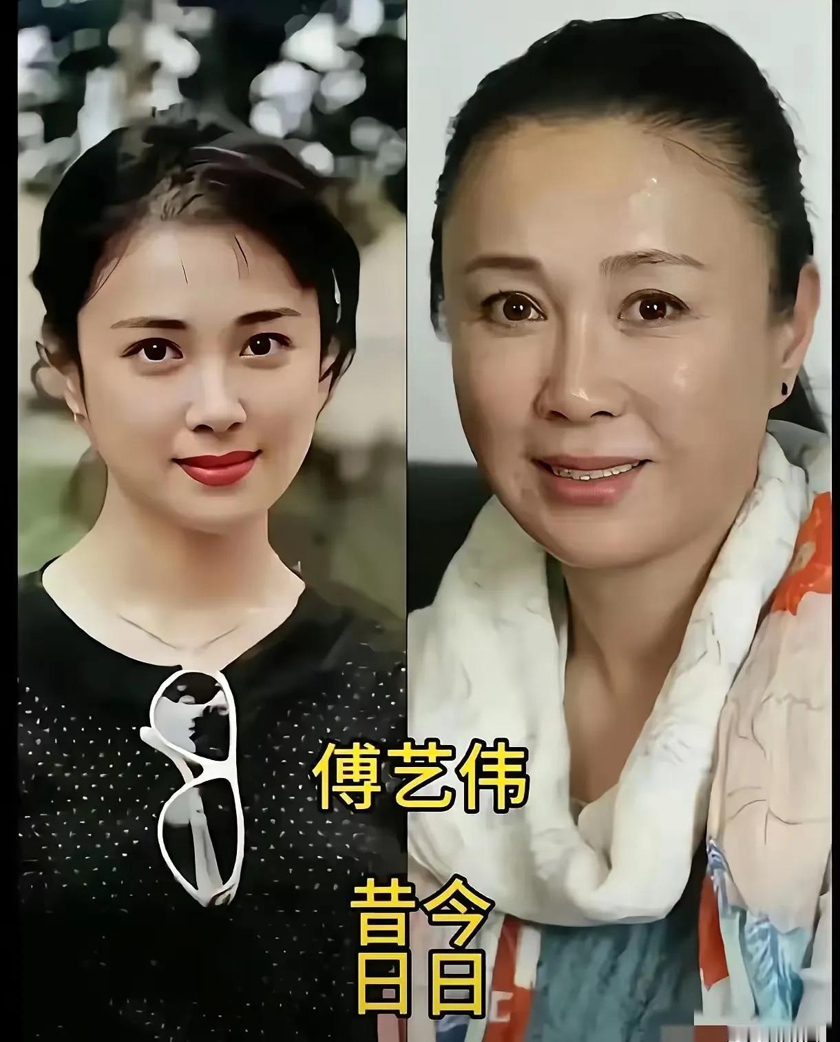 说句扎心的话，那个没有医美和滤镜的年代，可能再也回不去了。你还记得鞠萍吗？18