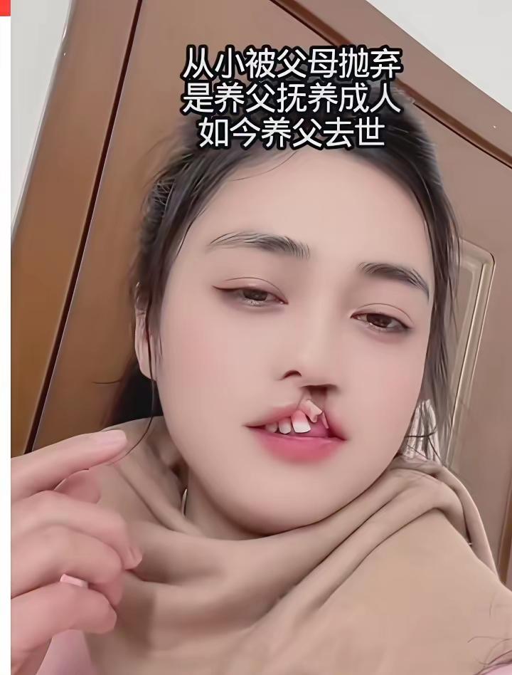 现在动手术是不是太晚了？这个手术得小时候做吧？