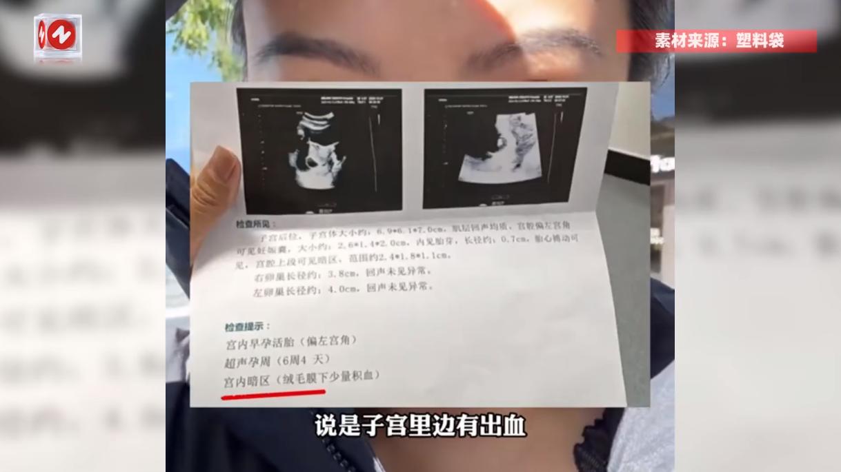 “肚里孩子差点给电没！”北京，一孕妇在床上铺了电热毯取暖，谁知没过几天竟然感觉腹