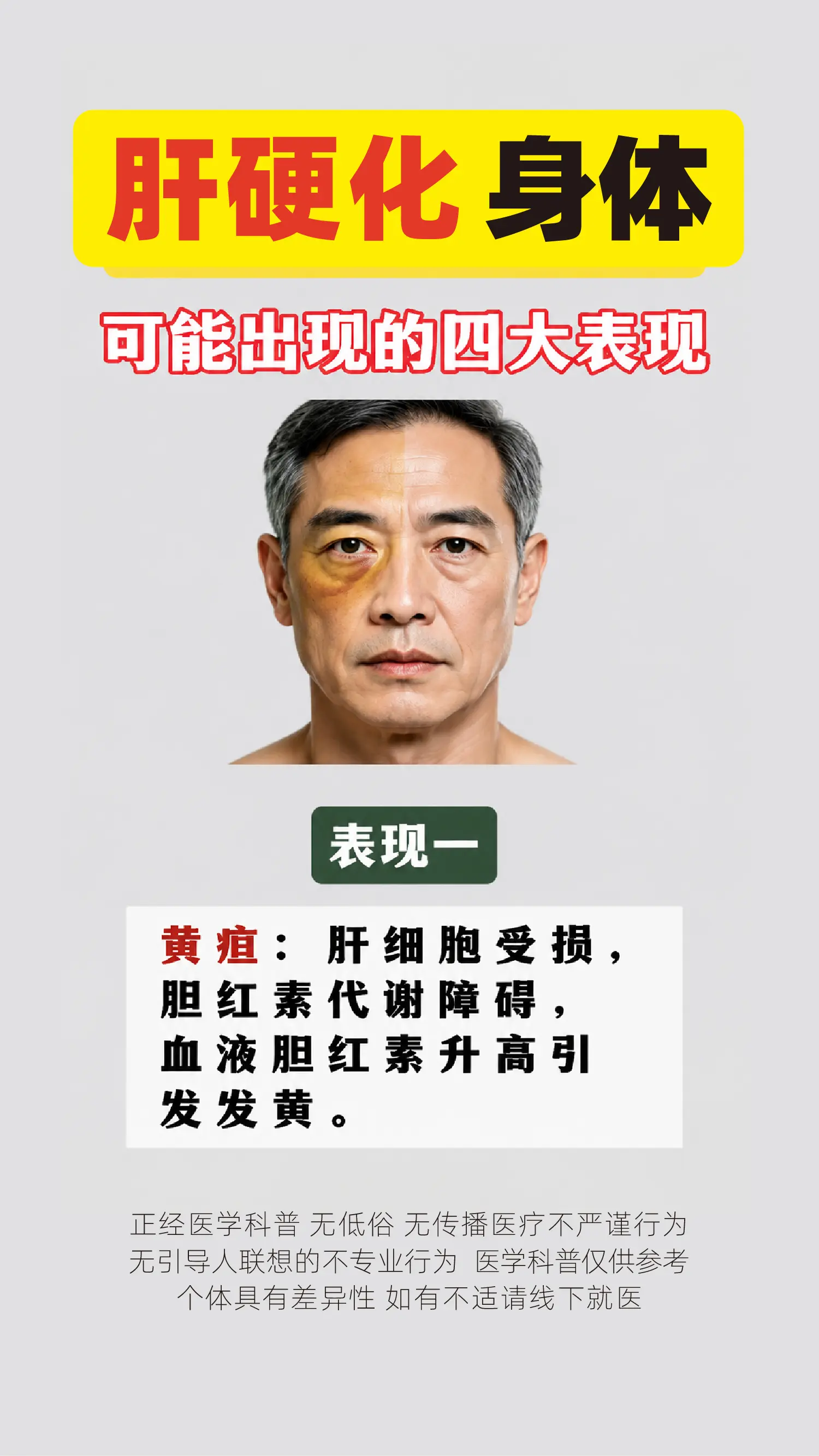 肝硬化，身体可能出现的4大表现。