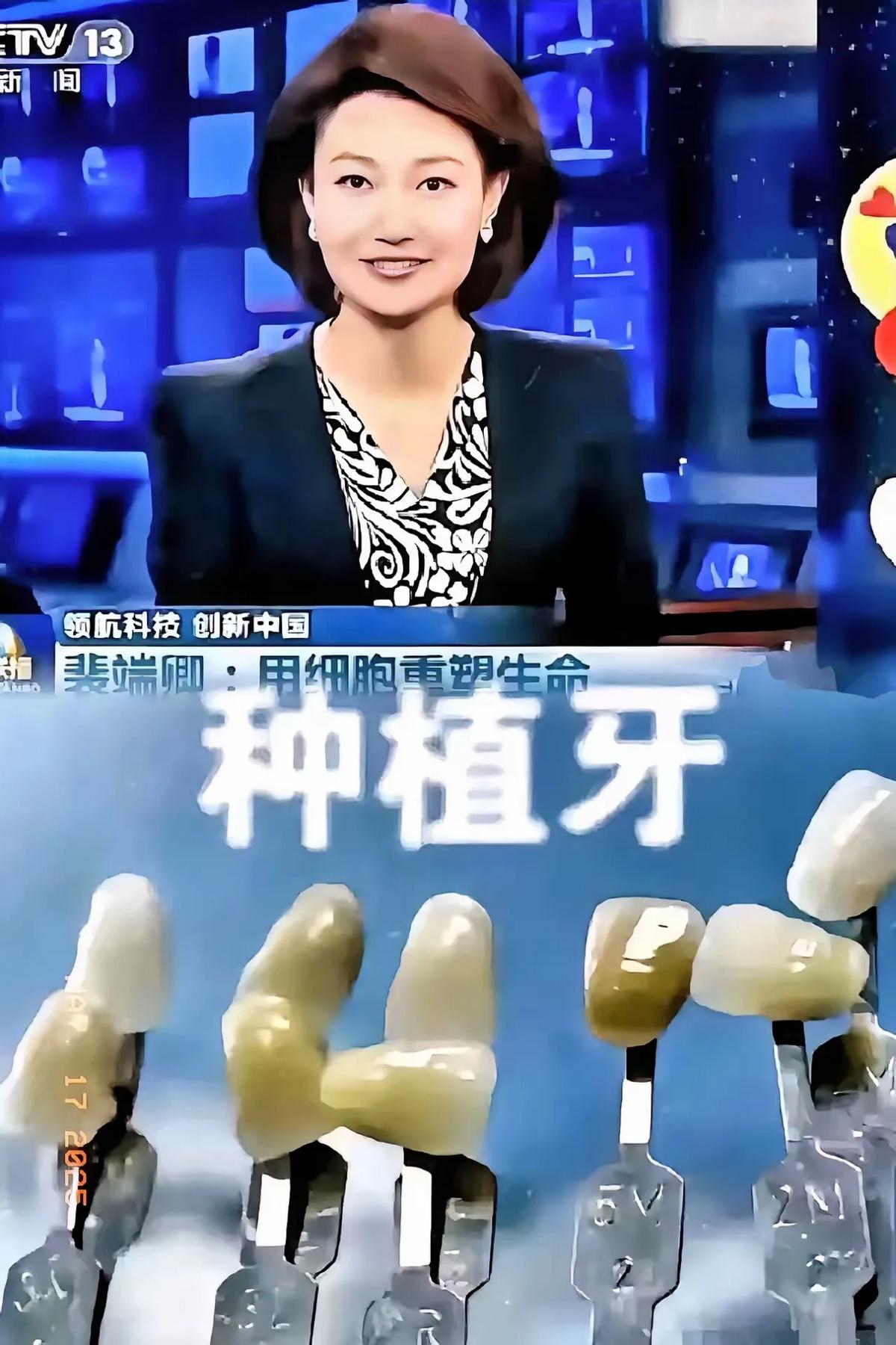 央视这消息一出，多少假牙厂要睡不着觉了。5月13日报道中科院裴端卿团队，把牙再