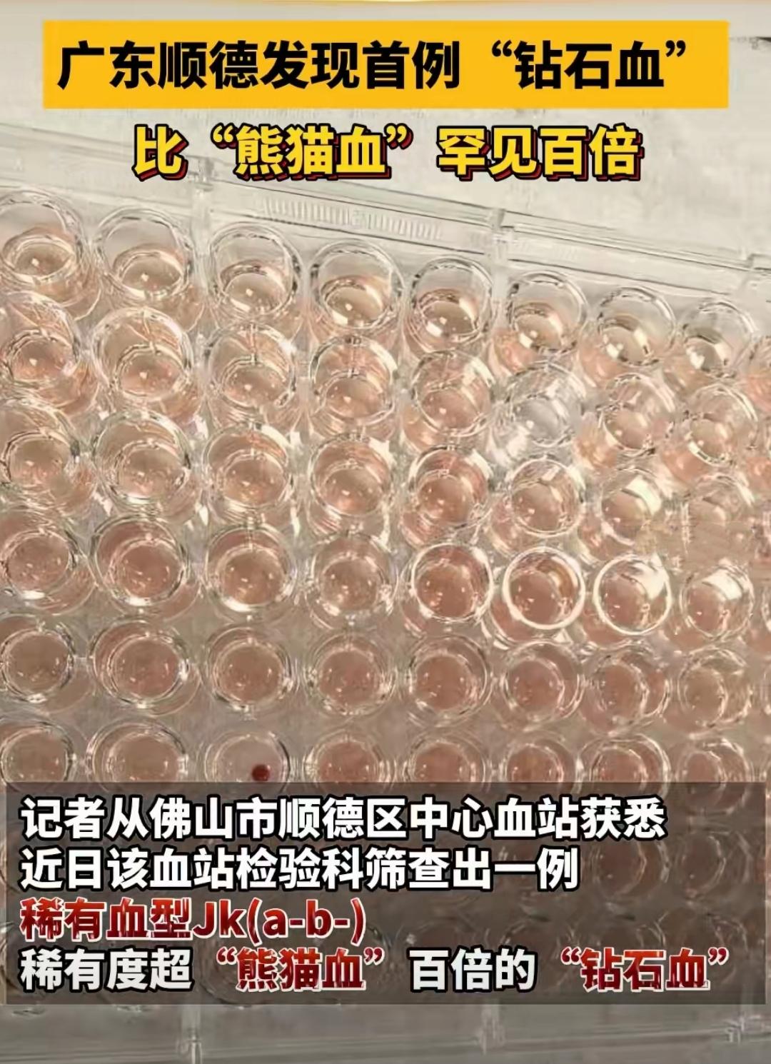 佛山顺德区中心血站最近爆出一条大新闻——当地首次发现“钻石血”血型，这种血型的稀