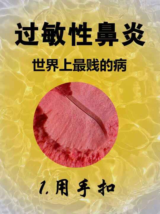 对过敏性鼻炎，终于有了清晰认知。。