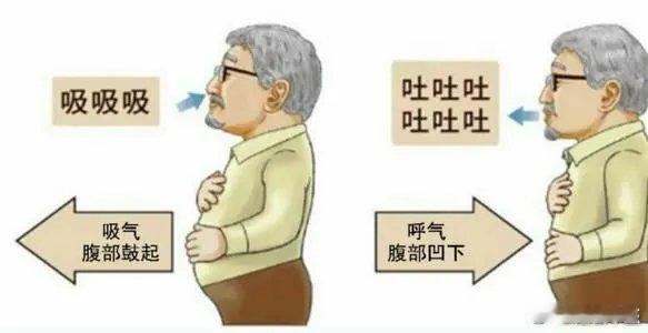 如何做呼吸功，来提高患者的心肺功能？1，全肺深呼吸：方法：直立、两脚与肩同宽、双