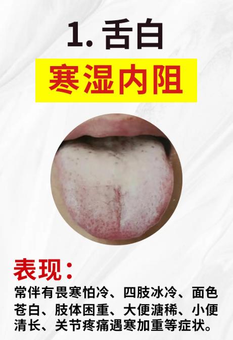 舌白的4种情况，很多人只知道寒湿
