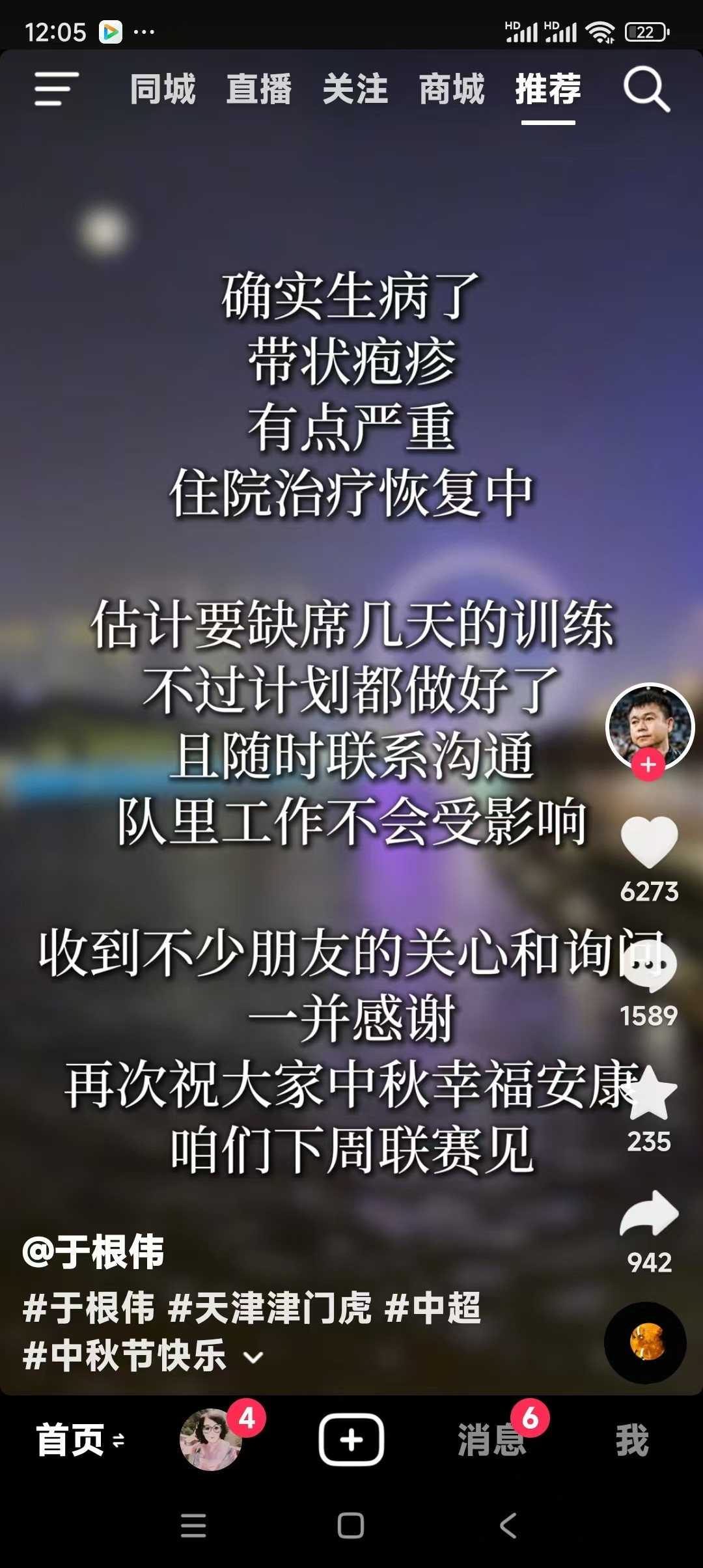 【今球讲】今天早上看到于根伟指导社交媒体回应大家，他得了带状疱疹病，正在治疗，是