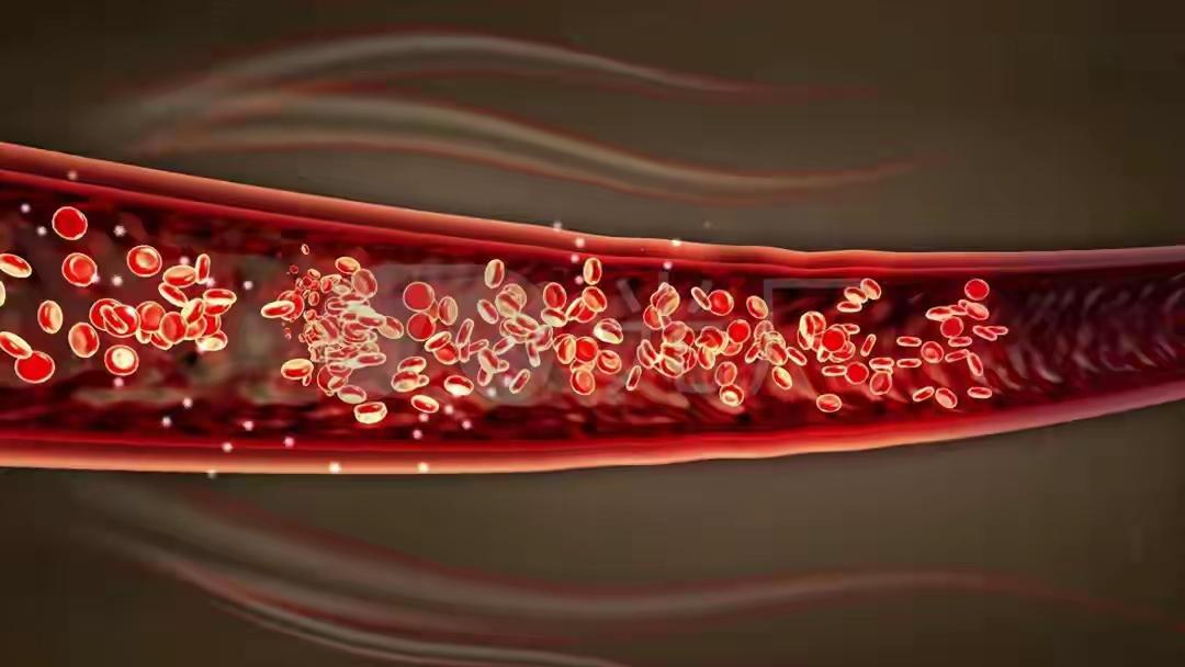 【收藏级救命帖】血管堵到什么程度，身体其实早就发了“微信”——只是很多人点