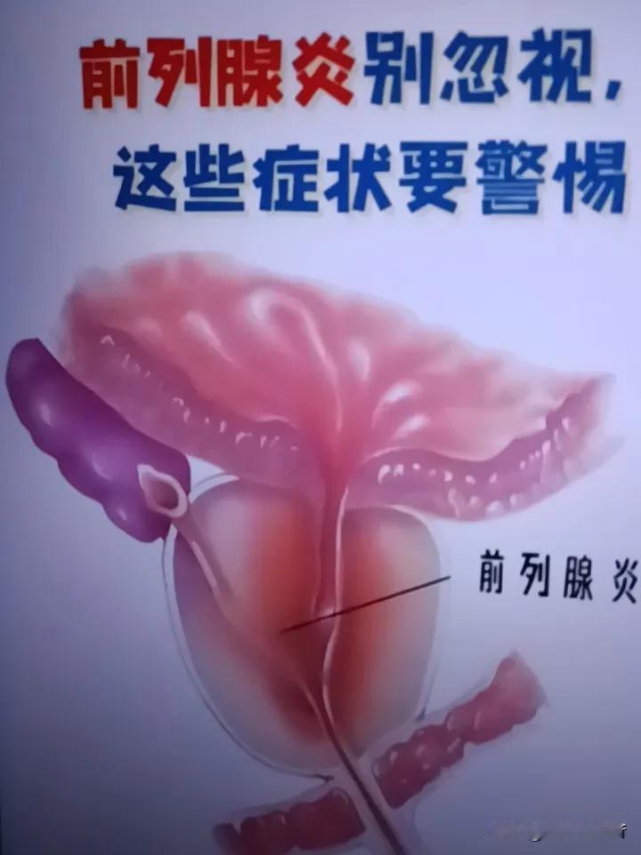 前列腺炎能完全自愈吗?前列腺炎这病挺磨人的，我