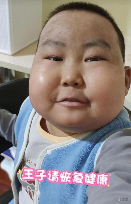 1月27日凌晨，10岁抗癌“小王子”豪豪不幸离世，父亲痛心坦言孩子终于解脱。4岁