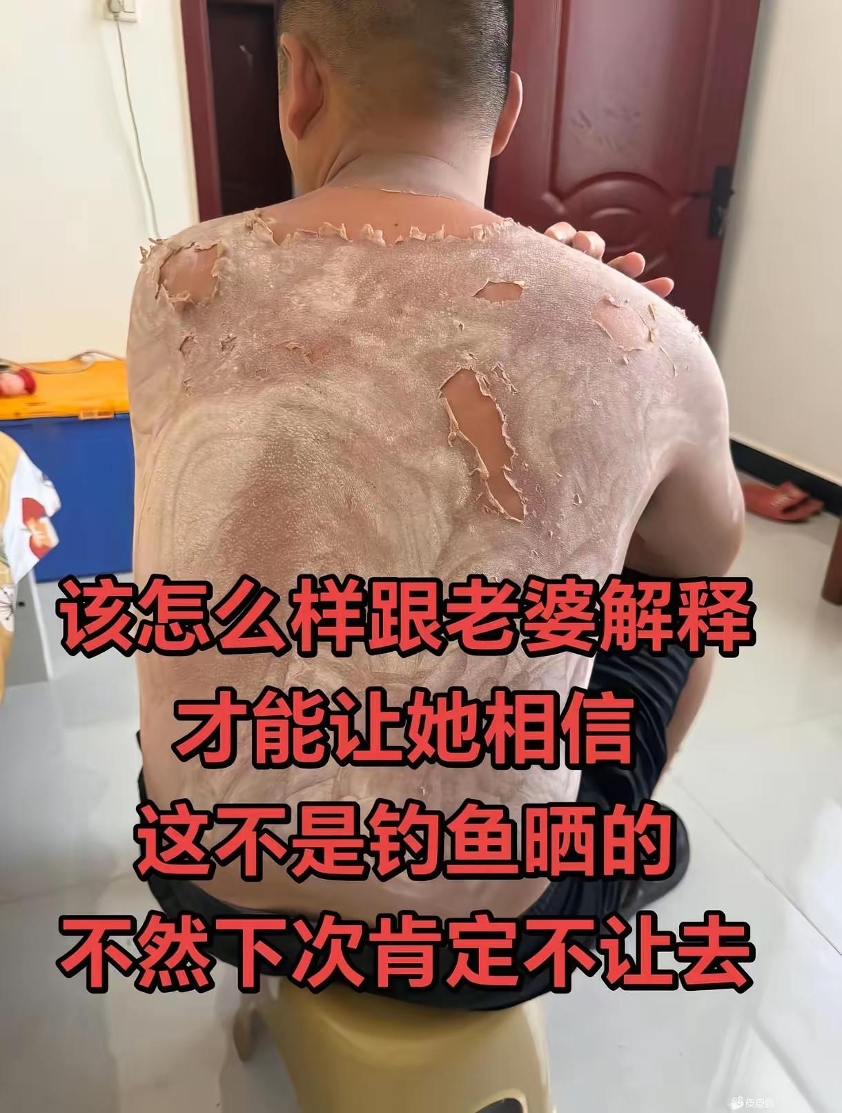 有点起鸡皮疙瘩