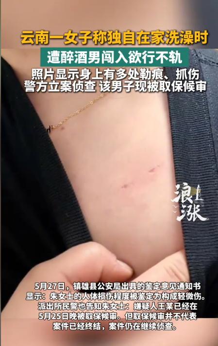 云南昭通31岁的朱女士，5月8日早上送女儿上学后独自在家洗澡。一名住1