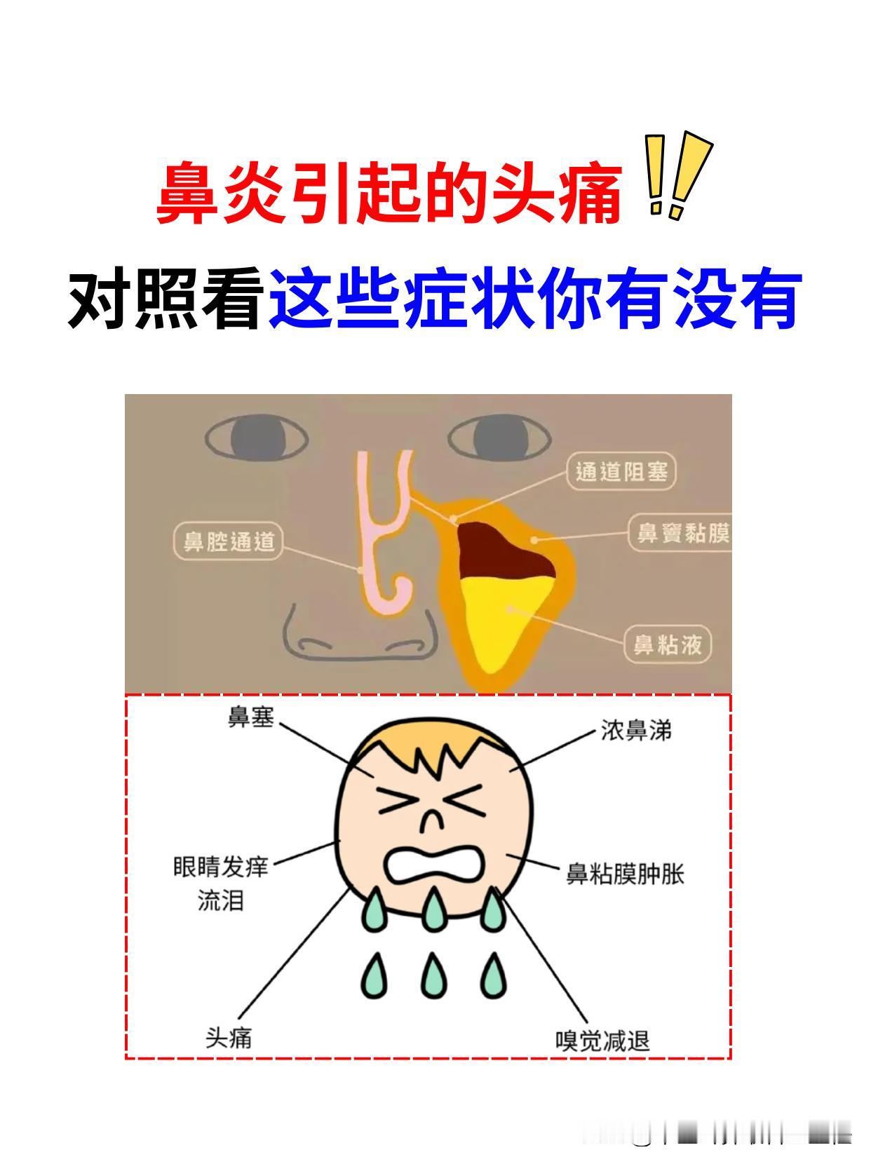 反复头痛，竟是鼻子惹的祸！快对照看这些症状你有没有！ 来到门诊上很多鼻炎都会