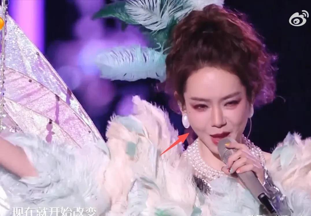 跨年夜最尴尬的三位女明星第一位：戚薇脸变形了，时间没安排到位，还没消肿就