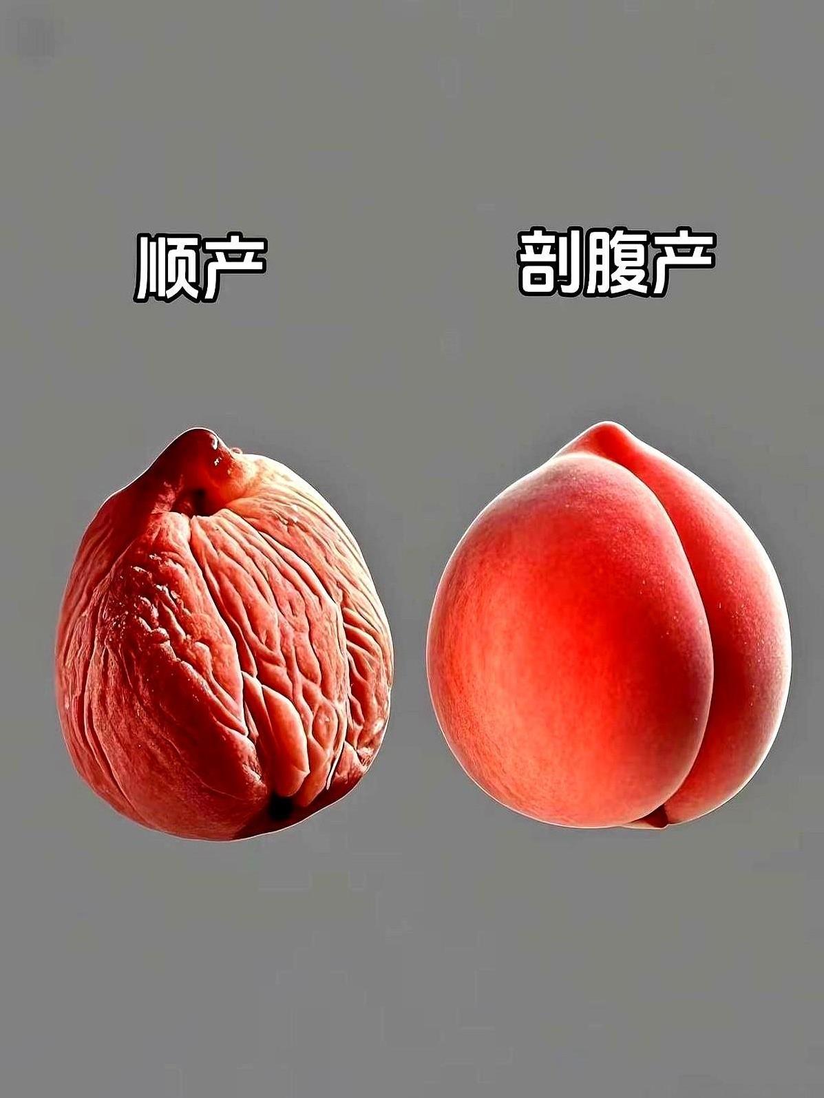 终于知道医生为啥都劝能顺就顺！你觉得是剖腹好还是顺的好呢？姐妹们听句实话，真
