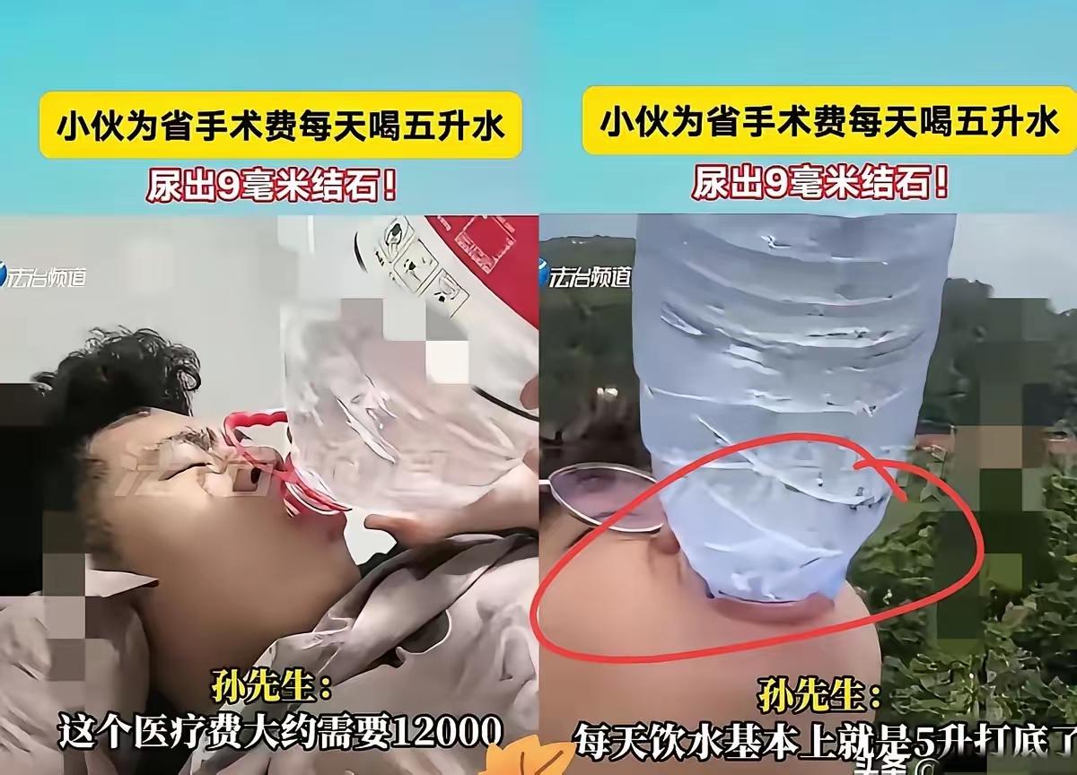 9毫米结石卡在输尿管，疼得孙先生直冒冷汗。医院报价一万二，他转身回家拎起5升大