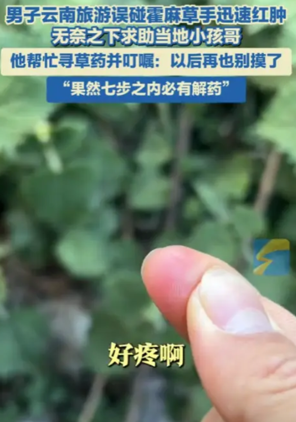 “这个小孩哥火了！”云南丽江，一男子去旅游误碰霍麻草，手迅速的红肿疼痛，无奈之下