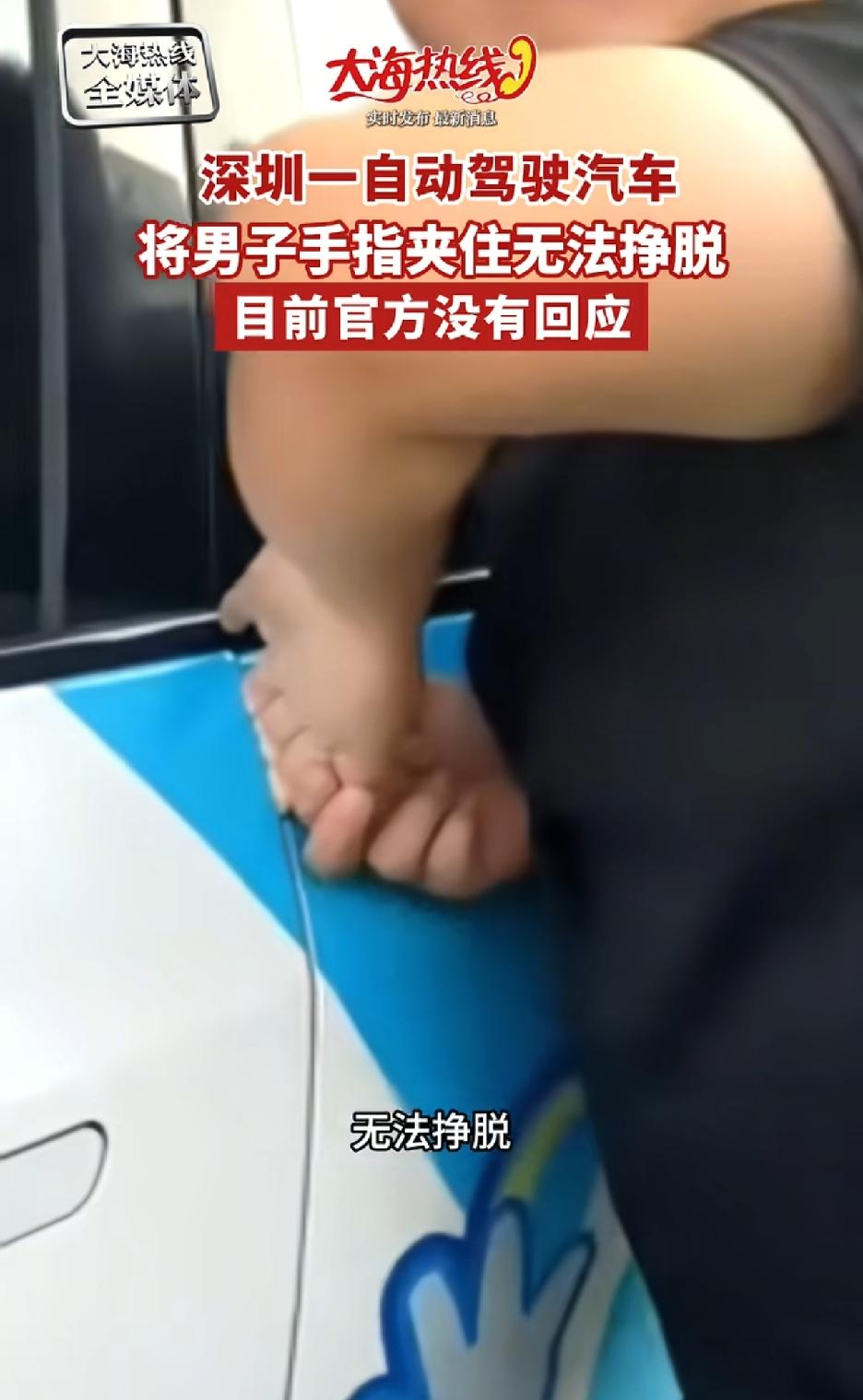 深圳一男子被无人驾驶车夹住三根手指，仔细看，这人的手指都变白，还叫人打客服电话，