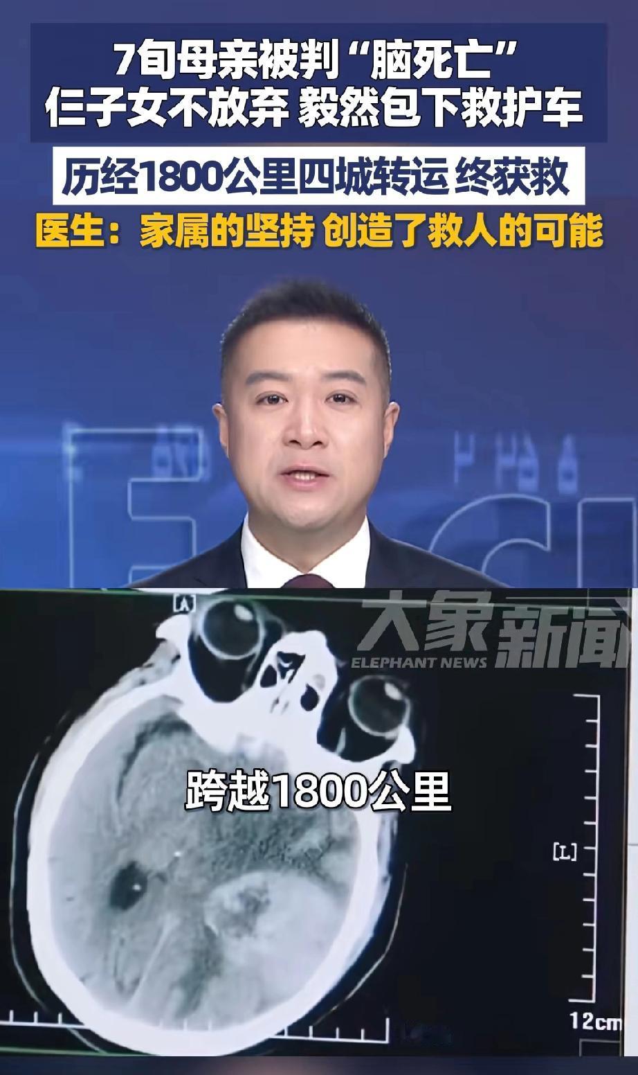 甘肃一位75岁老人脑肿瘤破裂，导致脑出血，医生初步诊断为脑死亡。然而，老人的三个