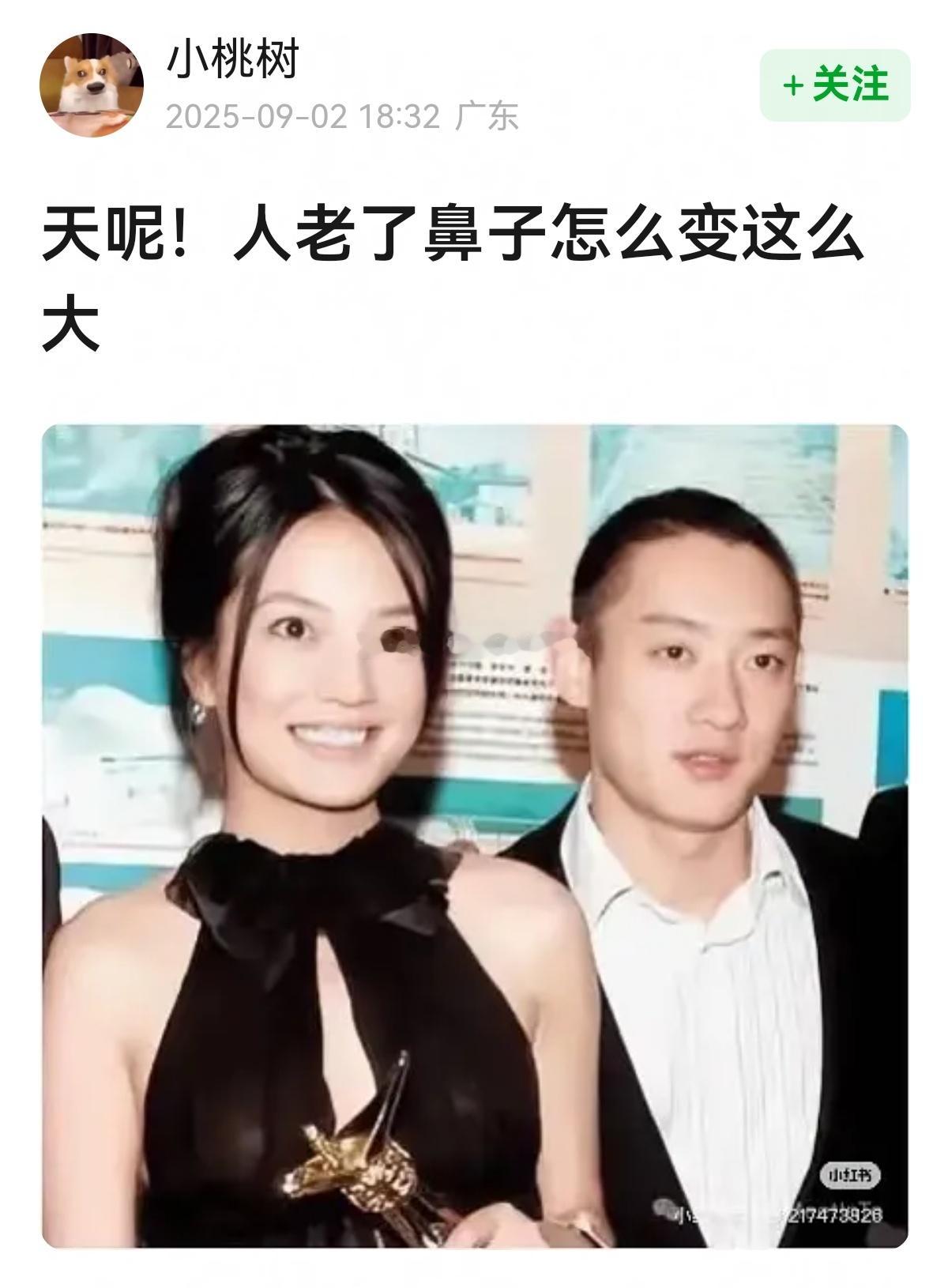 人老了鼻子会变大👃🏻👃🏻​​​
