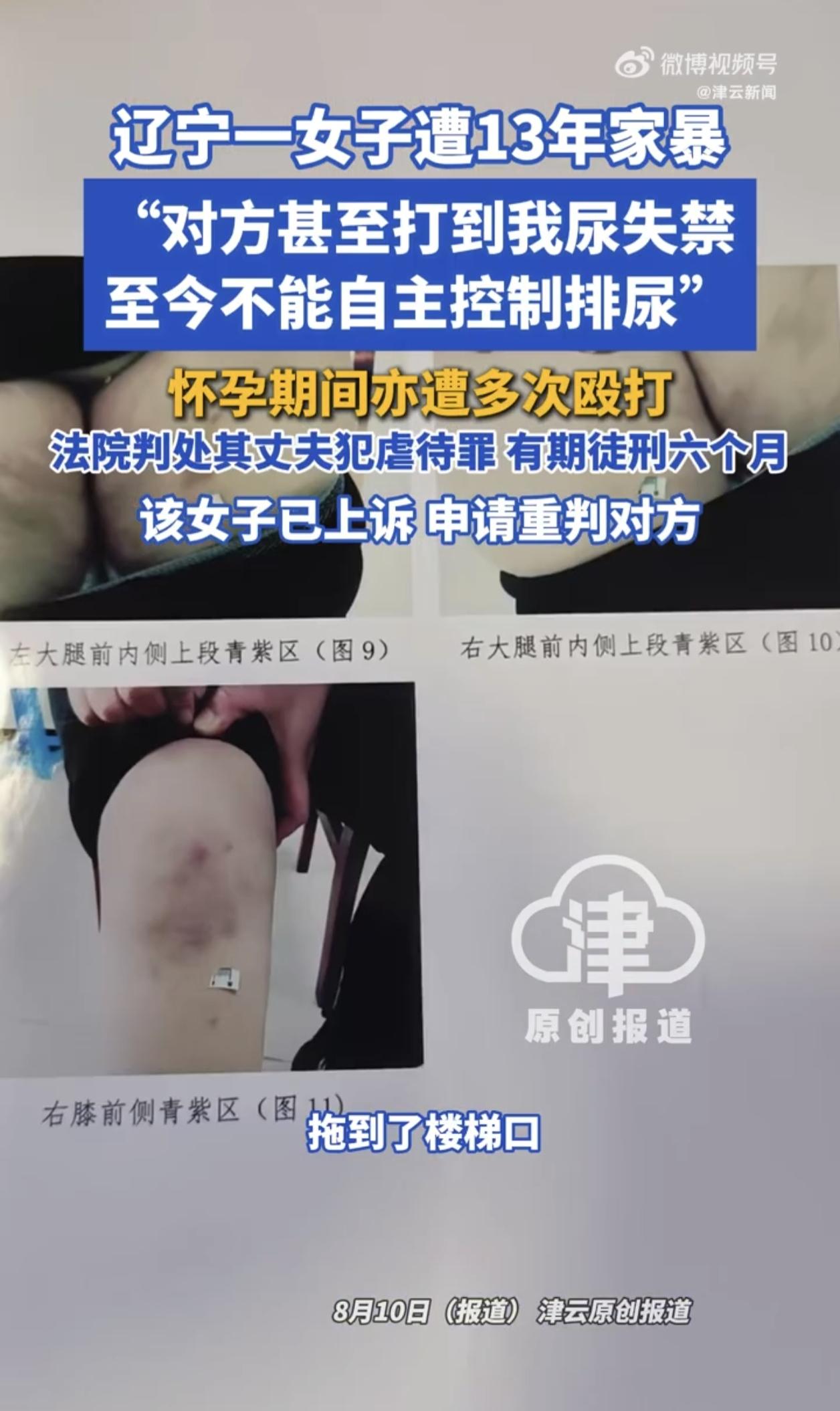 辽宁，一女子结婚15年，却被丈夫家暴了13年，就连怀孕两个月了还被扇耳光，怀孕八