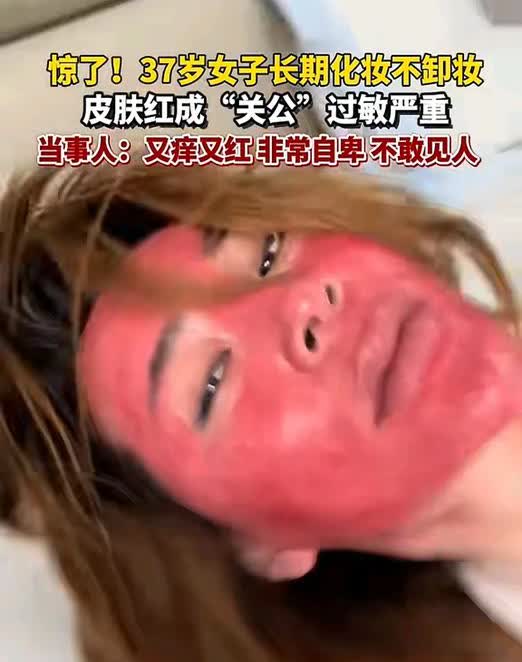 这女子长的得有多不堪，不敢以真面目示人，坚持22年化妆从不卸妆，结果把脸弄成红关
