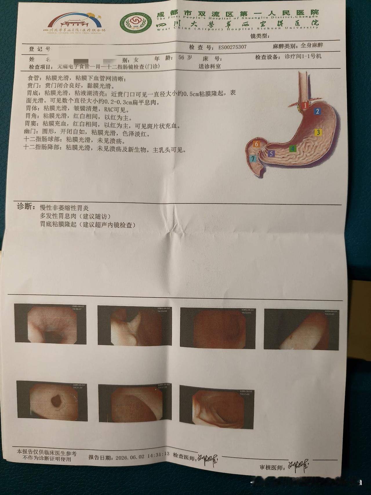 不会下棋，还是来摆会龙门阵吧？懂的朋友帮我看看，我这个是什么瘤子？今天去做了