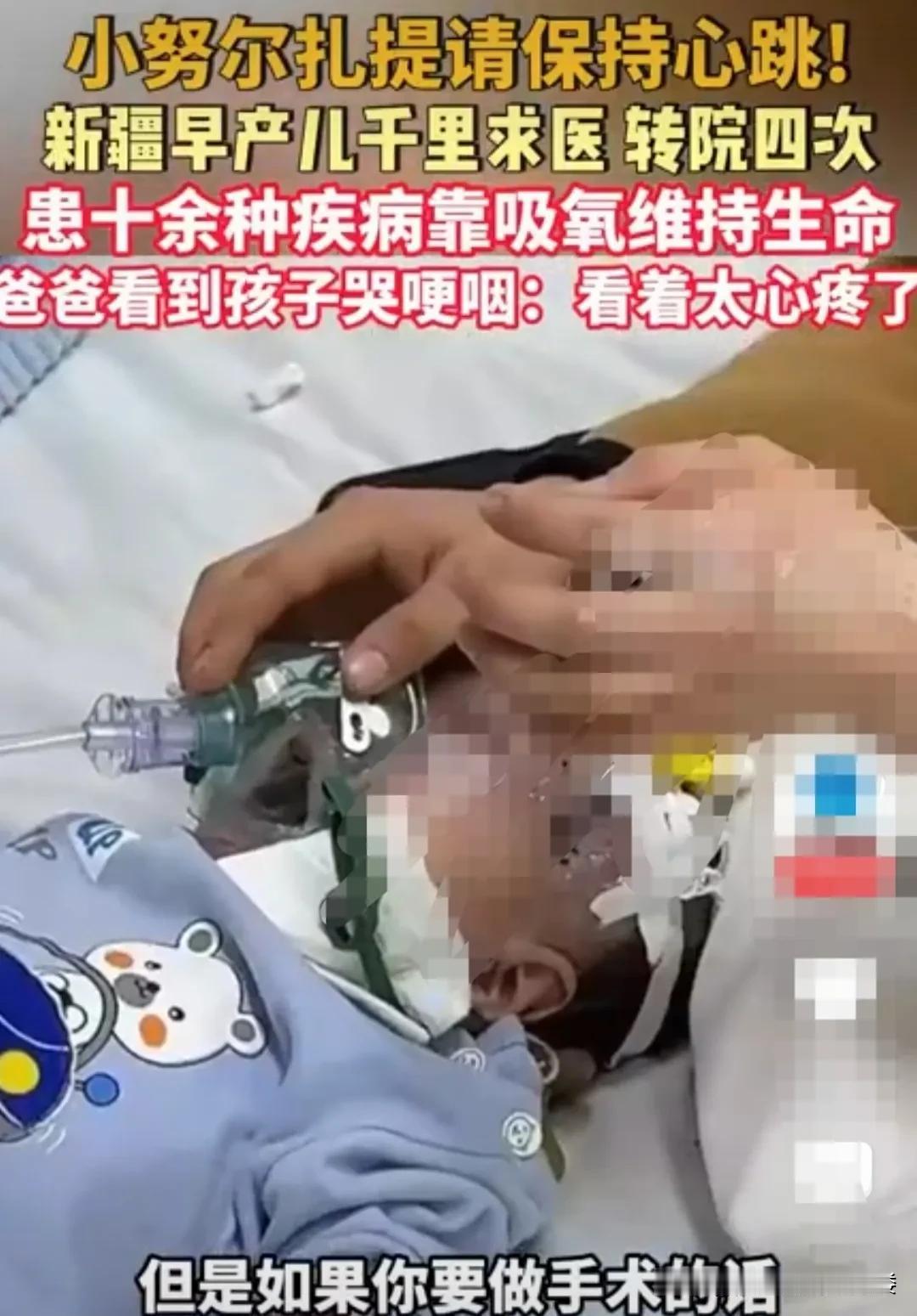 新疆，一小宝宝早产了，可怜他身患十几种疾病。自从出生以后，每天都靠吸氧维持生命。