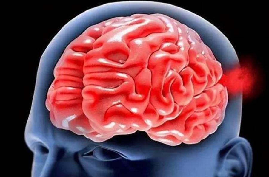 我发现脑出血的病人，最后的结果有三种。我在医院当护工第三年，遇上一个让大伙