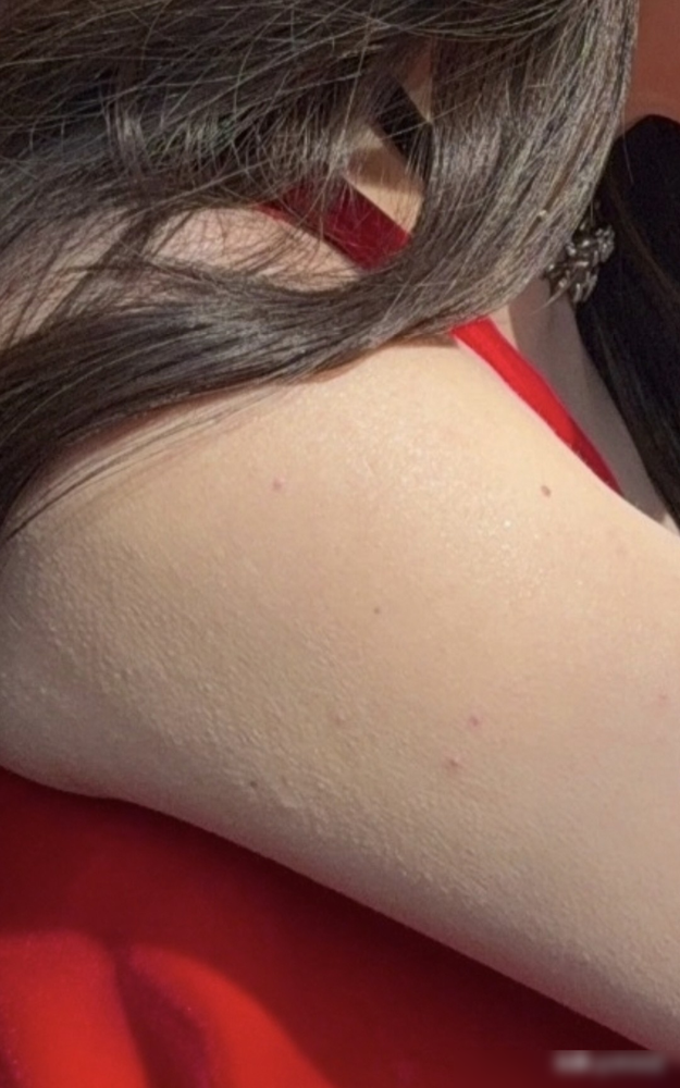 迪丽热巴胳膊上那一串红疙瘩，高清镜头怼着拍，她愣是没遮。巴黎迪奥大秀，别人精修图白到发光，她生图直接