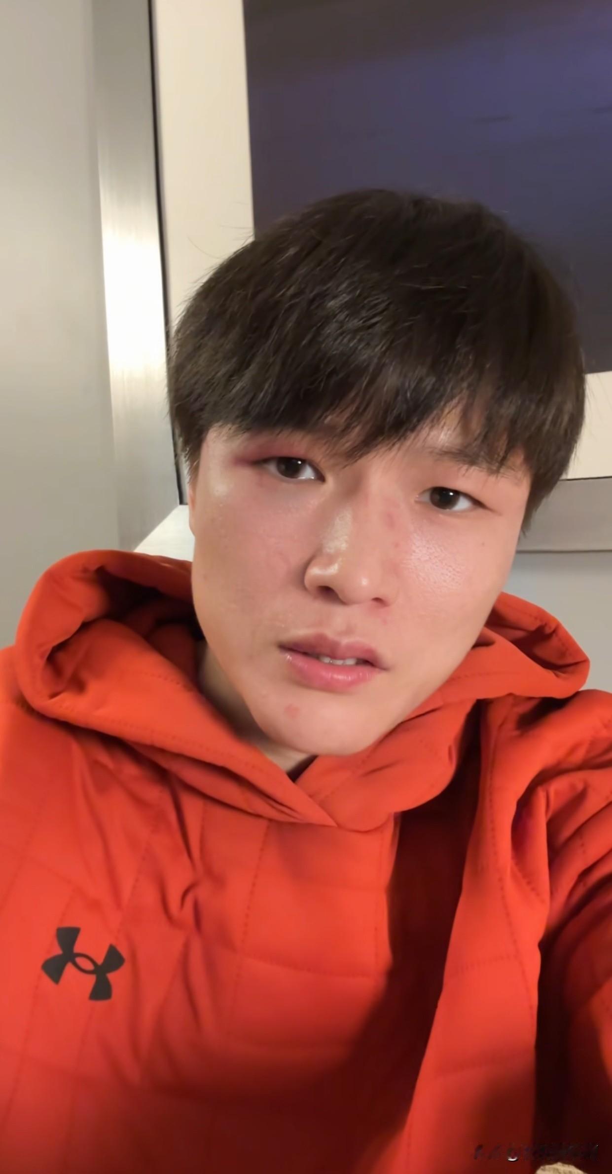 我喜欢张伟丽，但不喜欢她练的这个运动，看着太残忍了，也不敢看。和她比赛的这名