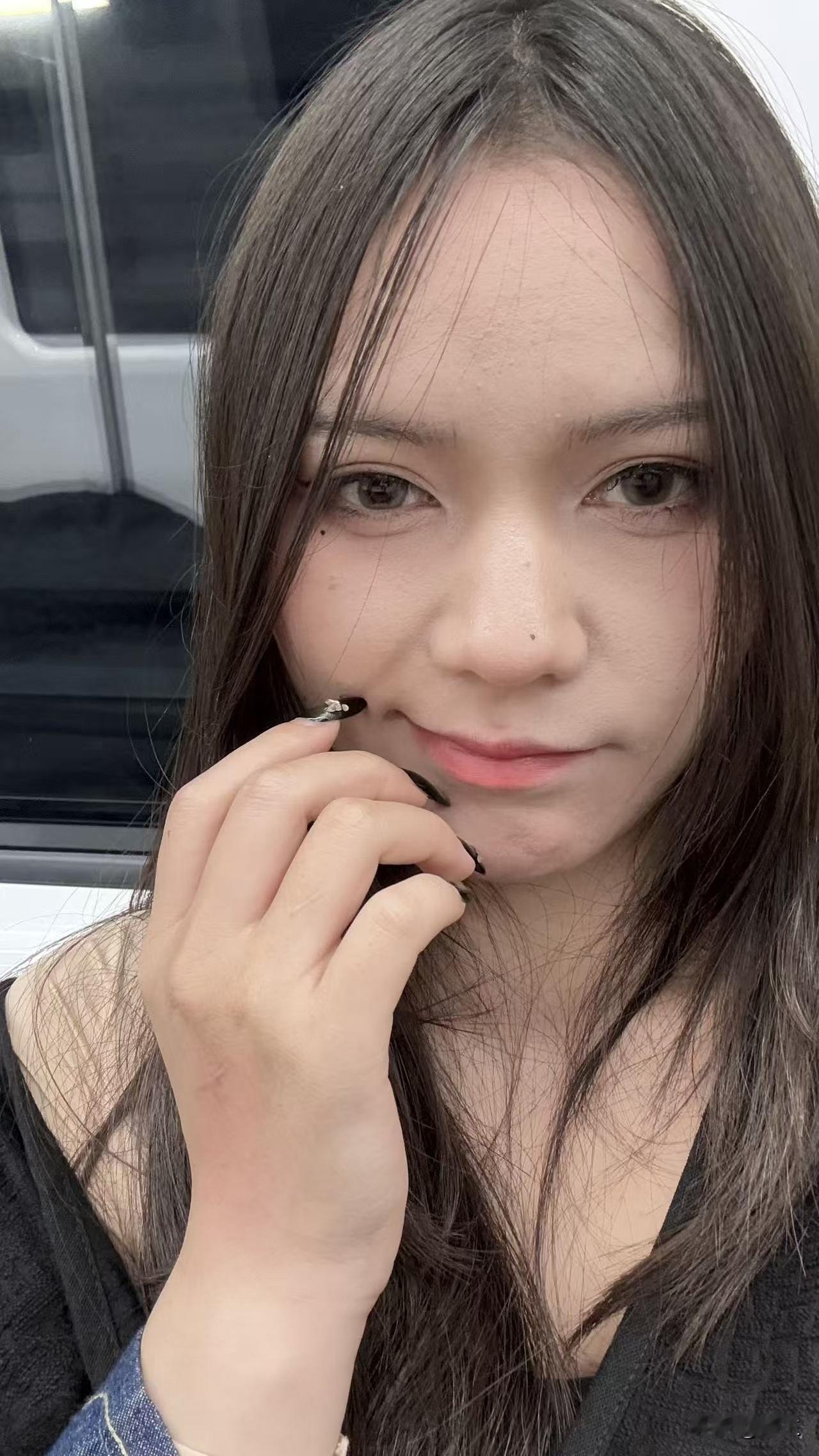 过年在家的时候，我堂妹看到我的皮肤，一个劲的夸我皮肤好，额头、脸、后背都没有长痘