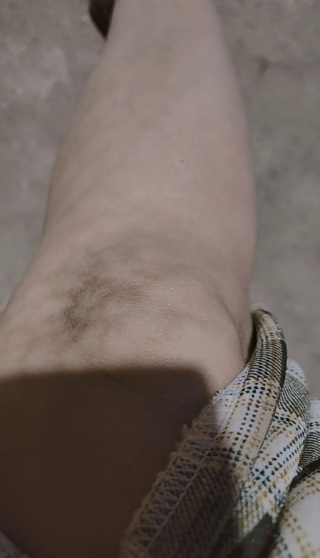 好家伙，火斑斑都烤出来了，不知道的还以为是长夹了一般人不知道是什么