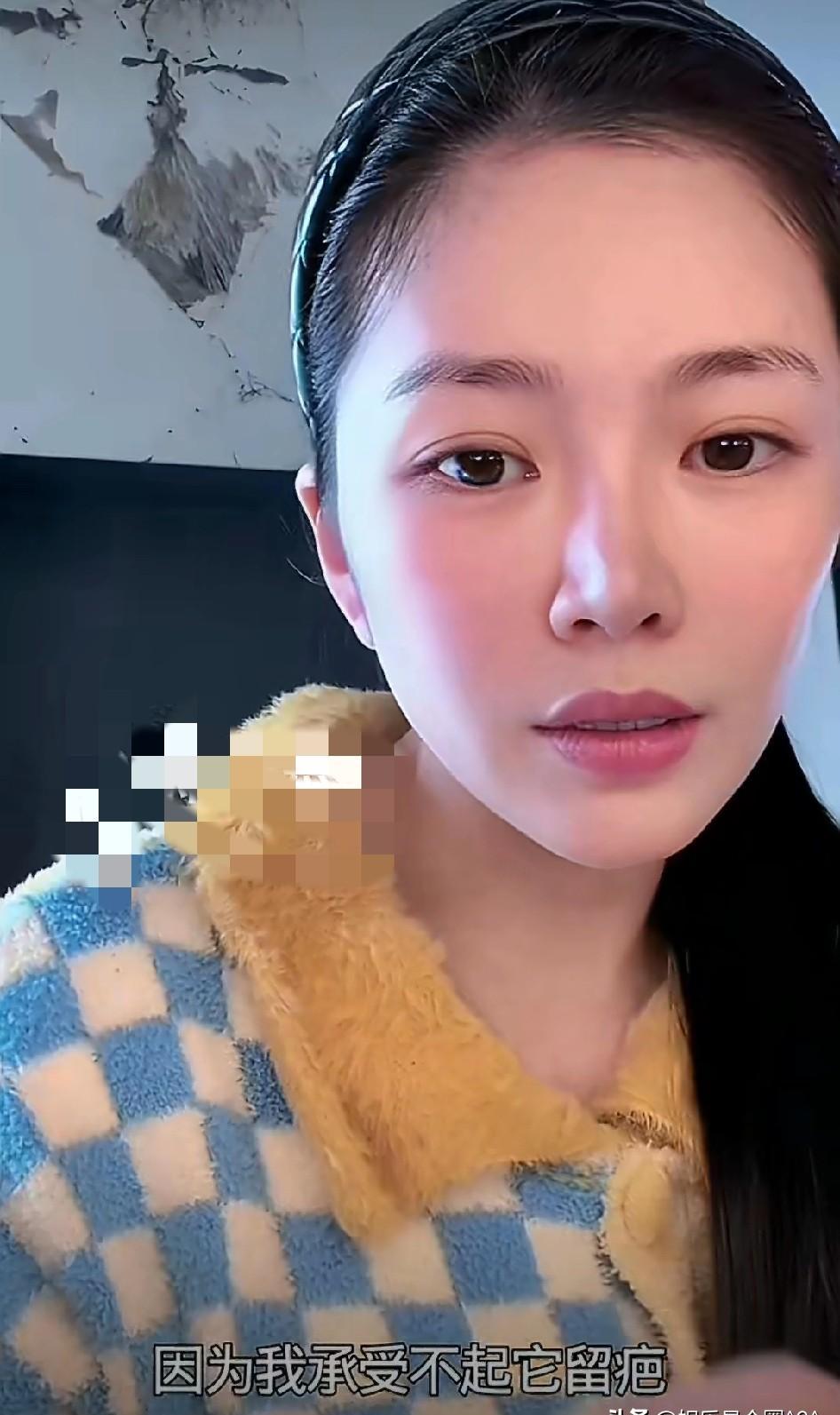 杜淳妻子直播回应整容质疑，一句话让全网沉默了！“我是疤痕体质，脸上动刀等于自毁